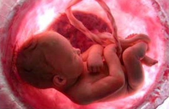 Aborto: estatísticas corretas permitem definir políticas em defesa da vida